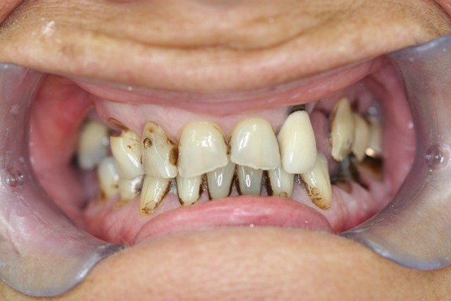 Detalle antes del tratamiento/ Details before treatment.
