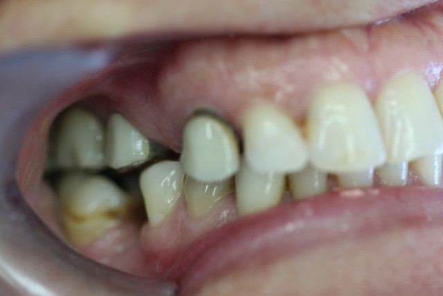 Detalle antes del tratamiento/ Details before treatment.