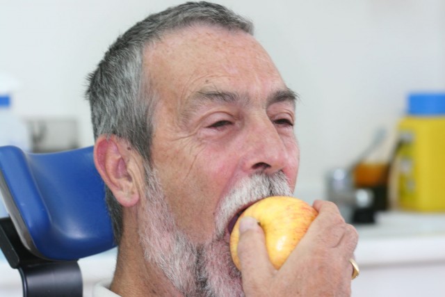 Paciente haciendo la prueba de la manzana inmediato a la cirugía.